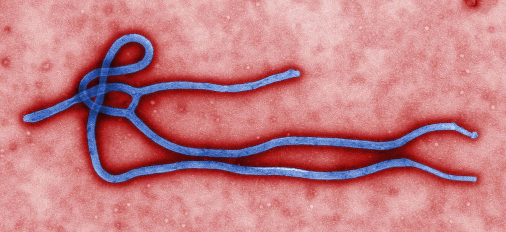 Electron micrograph of an Ebola virus virion
