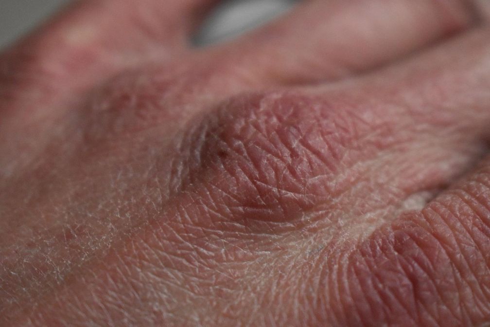 Trockene Haut an den Händen ist ein weitverbreitetes Problem in der kalten Jahreszeit. Naturkosmetik sorgt für geschmeidige Haut mit einem guten Gefühl.