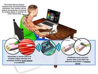 "HAPTIX": Prothese mit Gefühl