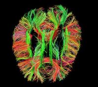 3D-Modell: das lebende menschliche Gehirn. Bild: humanconnectomeproject.org