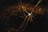 Forschung über Nervenzellen: Wissenschaftler wollen herausfinden, welche Rolle inhibitorische Intern
Quelle: Quelle: Marlene Bartos (idw)