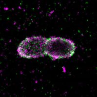 Salmonellen-Bakterien in einer menschlichen Zelle, umgeben von einem Mantel aus verschiedenartigen Ubiquitin-Markierungen. Quelle: Mike Heilemann/Ivan Dikic (idw)