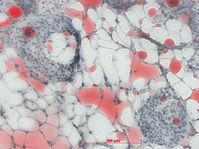 Fettzellen (weiss, mit rot gefärbten Lipideinlagerungen) neben einer Insulin-produzierenden Insel (blau) im Pankreas. Quelle: IDM Quelle: Bildquelle: IDM (idw)