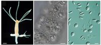 Süßwasserpolyp Hydra. Tier mit Fangarmen (Tentakeln) und Knospen (links); Tentakel mit Nesselzellen in Batteriezellen eines Tentakels (Mitte); isolierte z. T. entladene Nesselkapseln (rechts)
Quelle: Fotos: Nüchter und Holstein (links), Holstein (Mitte und rechts), Molekulare Evolution & Genomik, COS Heidelberg (idw)