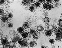Spiegeleiform des Herpes-simplex-Virus im TEM.