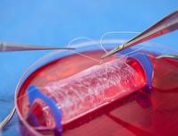 Künstlich hergestellte Vagina: Transplantat aus dem Labor. Bild: bit.ly/1efKpGK