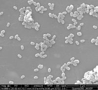 Rasterelektronische Aufnahme der mikroskopisch winzigen Apfelwickler-Granuloviren. Sie werden von de
Quelle: Katia Richert-Pöggeler (Julius- Kühn-Institut) (idw)