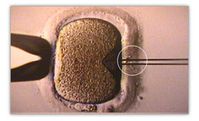 Künstliche Befruchtung einer Eizelle