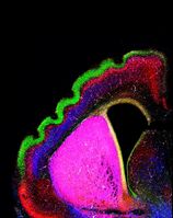 Ohne Adhäsions-Moleküle der FLRT-Familie bildet die normalerweise glatte Hirnrinde der Maus Falten aus, die in Aufbau und Struktur dem menschlichen Gehirn entsprechen. Quelle: MPI für Neurobiologie / del Toro, Cederfjäll (idw)