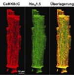 Immunologische Färbung einer Herzmuskelzelle. Foto: Maier