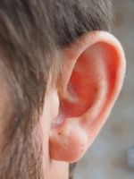 Ohr: Tinnitus kann lästig, sogar schmerzhaft sein.