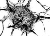Lange wurde angenommen, dass Mikrotubuli nur von einem zentralen Punkt, dem Zentrosom, entstehen können. Das Bild zeigt, dass in ausgereiften Nervenzellen mit inaktivem Zentrosom die Mikrotubuli (dunkle Striche) auch in ganz anderen Bereichen einer Nervenzelle entstehen können. Foto: Max-Planck-Institut für Neurobiologie / Stiess & Bradke