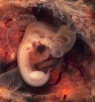 Mensch in der 5. Woche p.c. (7. SSW, Embryo).