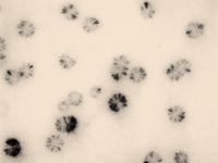 Mykoplasmen können trotz ihres minimalen Genarsenals dem Immunsystem ihres Wirts entkommen.
Quelle: Institut für Mikrobiologie/Vetmeduni Vienna (idw)