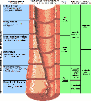 Schematisch: Phasen der Atherosklerose