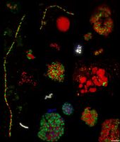 Mikroskop-Aufnahmen methanotropher Mikroorganismen verschiedener Methanquellen.
Quelle: Katrin Knittel/Emil Ruff, MPI Marine Mikrobiologie, Bremen (idw)