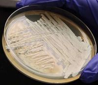 Hefezellen in einer Petrischale im Labor.