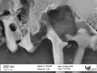 Die Abbildung zeigt eine Aufnahme mit dem Transmissionselek-tronenmikroskop einer Magnesiumlegierung des Nano-Analytik-Labors des Lehrstuhls Metallische Werkstoffe. Man beachte die Länge des Maßbalkens links unten im Bild: Sie beträgt ungefähr 1/500 der Dicke eines menschlichen Haares. UBT-Pressestelle