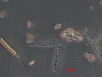 Lichtmikroskopische Aufnahme von Eisalgen. Bild: Juliane Müller, Alfred-Wegener-Institut