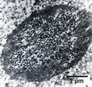 Unterm Elektronenmikroskop: Kern der Mitteldarmzelle eines Nashornkäfers mit stäbchenförmigen Viren. Foto: BBA/Inst. f. biolog. Pflanzenschutz
