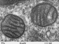 Elektronenmikroskopische Aufnahme von Mitochondrien