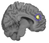 Die Region im Präfrontalkortex, die bei der Schärfung der Wahrnehmung („Wahrnehmungs-lernen“) eine Rolle spielt. mod. nach Kahnt et al., 2011