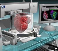 Organdruck: Technologie setzt sich 2016 durch. Bild: wikia.com