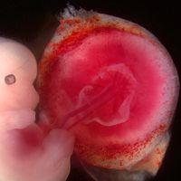 Menschliche Plazenta mit Baby (Fötus)