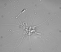 Rinderspermien in Hellfeldmikroskopie mit Differentialinterferenzkontrast.
Quelle: (c) Dr. Veronika Magdanz (idw)