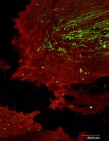 Bei einer Verletzung des Rückenmarks (schwarzer Spalt) werden die Fortsätze von Nervenzellen (grün) durchtrennt. Die Nervenzellen stellen ihr Wachstum ein und schwellen an. Wissenschaftler konnten nun zeigen, dass ein erneutes Wachstum dieser Zellen im Prinzip jedoch möglich ist. Max-Planck-Institut für Neurobiologie / Bradke