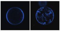 Membranbläschen mit (links) und ohne das Protein Mic10 (rechts). Mic10 führt zu Einstülpungen der Me
Quelle: Foto: Meinecke (idw)