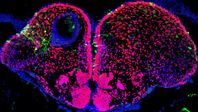 Regeneration des Zebrafischgehirns: Die Körper der neuronalen Stammzellen (radiale Gliazellen, grün) befinden sich am äußeren Rand des Gehirns. Aus diesen Vorläuferzellen entstehen viele neuen Nervenzellen (gelb), die in der geschädigten linken Hirnhälfte tief in das Verletzungsgebiet in der Mitte einwandern. Der Stichkanal ist 21 Tage nach der Verletzung noch deutlich durch die Ansammlung von Blutzellen (blau) erkennbar. In der rechten gesunden Hirnhälfte hingegen befinden sich die neugebildeten Nervenzellen (gelb) ausschließlich am Rande des Gehirns. Die fadenartigen grünen Strukturen innerhalb des Gehirns sind die langen Fortsätze der radialen Gliazellen.
Quelle: ©CRTD/Kroehne (idw)