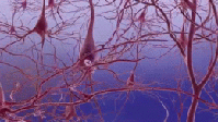 Fortschreiten der Alzheimer-Krankheit, Absterben von Neuronen sowie Bildung von neurofibrillären Tangles und beta-Amyloid-Plaques