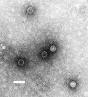 Poliovirus (negativ gefärbte TEM-Aufnahme; Balken: 50 nm)