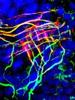 Antikörperfärbung eines Haarfollikels: Durch Kopplung der Antikörper an verschiedene Farbstoffe können unterschiedliche Strukturen mikroskopisch sichtbar gemacht werden. Man sieht im Haarfollikel endende Nervenendigungen (grün), in denen elektrische Impulse durch mechanische Reize der Haut erzeugt werden. In diesen Endigungen sind KCNQ4 Kaliumkanäle lokalisiert (rot), welche die Generierung dieser Nervenimpulse regulieren. Ovale und runde Strukturen in Blau zeigen Zellkerne von Zellen in der Haut.
Quelle: Grafik: M. Heidenreich (idw)