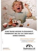 Bild: obs/Paulinchen e.V. - Initiative für brandverletzte Kinder