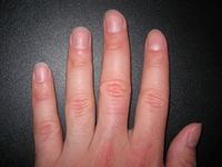 Fingernägel eines Menschen