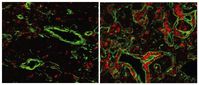 Der normale Thymus einer Maus (links) enthält nur wenige B-Zellen (rot). Wenn das Gen FOXN4 aktivier
Quelle: MPI für Immunbiologie und Epigenetik (idw)