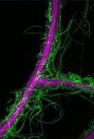 Mikroskopischer Ausschnitt einer Arabidopsis thaliana-Wurzel (violett), die mit Pilzgeflecht von Colletotrichum tofieldiae (grün) umgeben ist. Quelle: MPI f. Pflanzenzüchtungsforschung (idw)