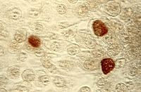 Aufnahme von Chlamydien-Einschlusskörperchen in menschlichen Zellen: Effektor-Proteine spielen bei der Bildung dieser Einschlusskörperchen eine wichtige Rolle. Bild: CDC/ Dr. E. Arum, Dr. N. Jacobs