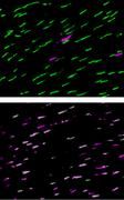 Fluoreszenzmikroskopische Aufnahmen der Zapfenzellen in der Retina einer erwachsenen gesunden Ratte (oben) und einer erwachsenen hypothyreoten Ratte (unten). Die Zapfentypen wurden mit Antikörpern gegen die Opsine angefärbt, das Grün-Opsin ist grün und das UV/Blau-Opsin purpur dargestellt. Die gesunde Ratte besitzt viele Grünzapfen und wenige UV/Blau-Zapfen. Eine Abnahme des Schilddrüsenhormonspiegels führt zur Bildung von UV/Blau-Opsin in allen Zapfen und der Abnahme von Grün-Opsin. Die heller purpur erscheinenden Zapfen im unteren Bild sind solche, die neben viel UV/Blau-Opsin auch etwas Grün-Opsin enthalten. Martin Glösmann