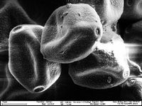 Haselpollen lösen oft schon Februar Allergien aus, da die Pflanze früh im Jahr blüht. Im Max-Planck-Institut für Chemie entstand diese elektronenmikroskopische Aufnahme von Haselpollen. Quelle: Antje Sorowka, Max-Planck-Institut für Chemie (idw)