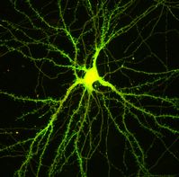 Kultivierte Nervenzelle (rot). Nach Stimulation hat sich Copine-6 (grün) an den zahlreichen Synapsen der Empfängerzelle angereichert. Quelle: Universität Basel, Biozentrum (idw)
