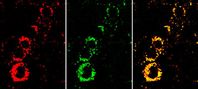 Nanosensoren zeigen durch das gelbe Signal im Überlagerungsbild (rechts), dass die Zellen aktiv sind. Wären sie in einem schlechten Zustand , wären sie deutlich röter. Mitte: Signal des Indikatorfarbstoffs. Links: Signal des Referenzfarbstoffs. Bild: Fraunhofer EMFT (idw)