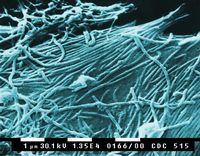 Elektronenmikroskopische Aufnahme von Ebolaviren