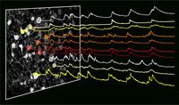 Nervenzellen vom Typ HTR2a in der Amygdala der Maus sind während des Essens aktiv (Ausschläge in den Aktivitätskurven), wodurch die Nahrungsaufnahme gefördert wird. Quelle: © MPI für Neurobiologie / Douglass & Kucukdereli (idw)