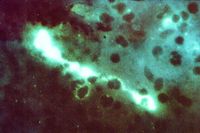Chlamydien: Chlamydophila psittaci, Färbung durch direkte Immunfluoreszenz mit fluoreszierenden Antikörpern (FA)