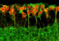 Längsschnitt durch die Netzhaut einer blinden Maus, die mit Opto-mGluR6 therapiert wurde. Die Opto-m
Quelle: Sonja Kleinlogel (idw)