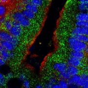 Darmzellen unter dem hochauflösenden Mikroskop: Die Oberfläche ist rot markiert, die Zellkerne sind blau angefärbt. Das Transportprotein FATP4 ist grün angefärbt und liegt eindeutig im Zellinneren. Foto: Universitätsklinikum Heidelberg