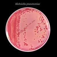 Das Bakterium Klebsiella pneumoniae gehört zu den häufigsten Erregern in Krankenhäusern.
Quelle: Centers for Disease Control and Prevention (idw)